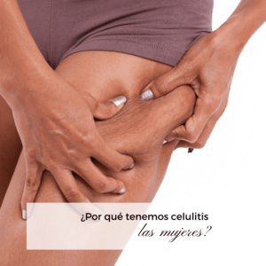 celulitis en mujeres
